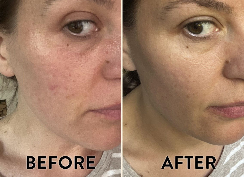 CBD Superboost Face Oil